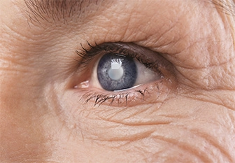 Closeup photo of an eye